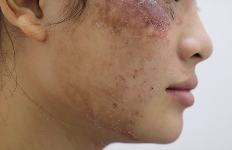 Unpredictable dangers from rapid beauty. Photo: BVCC