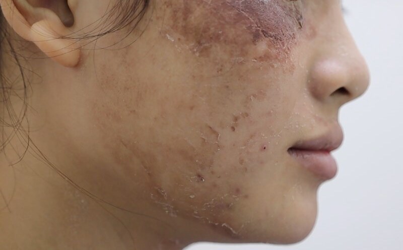 Unpredictable dangers from rapid beauty. Photo: BVCC