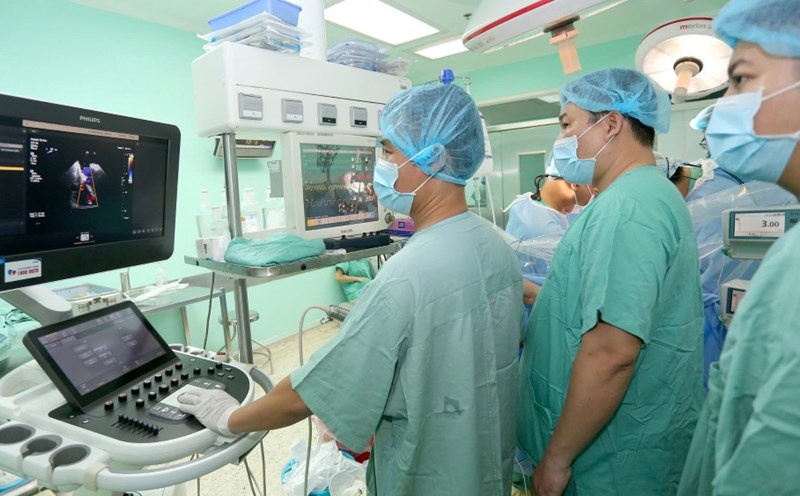Heart transplant