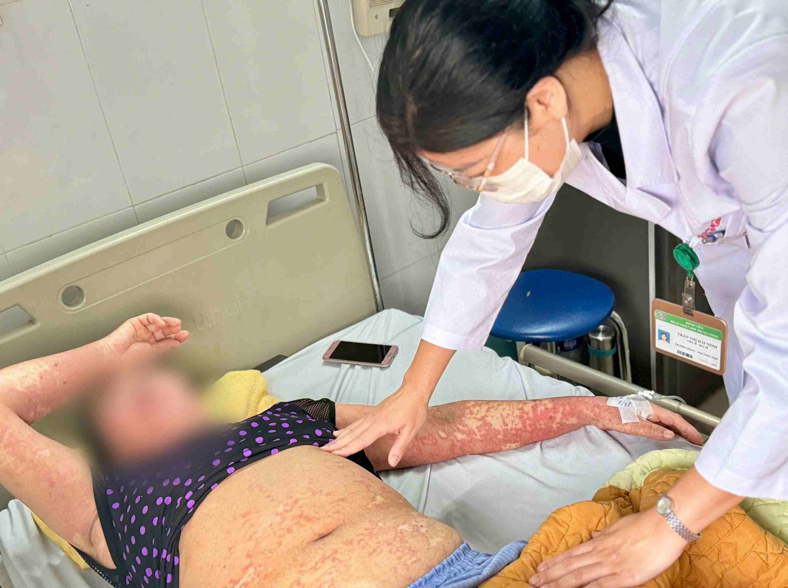 People with severe allergies are treated by doctors at the Central Hospital for Tropical Diseases. Photo: Thanh Dang