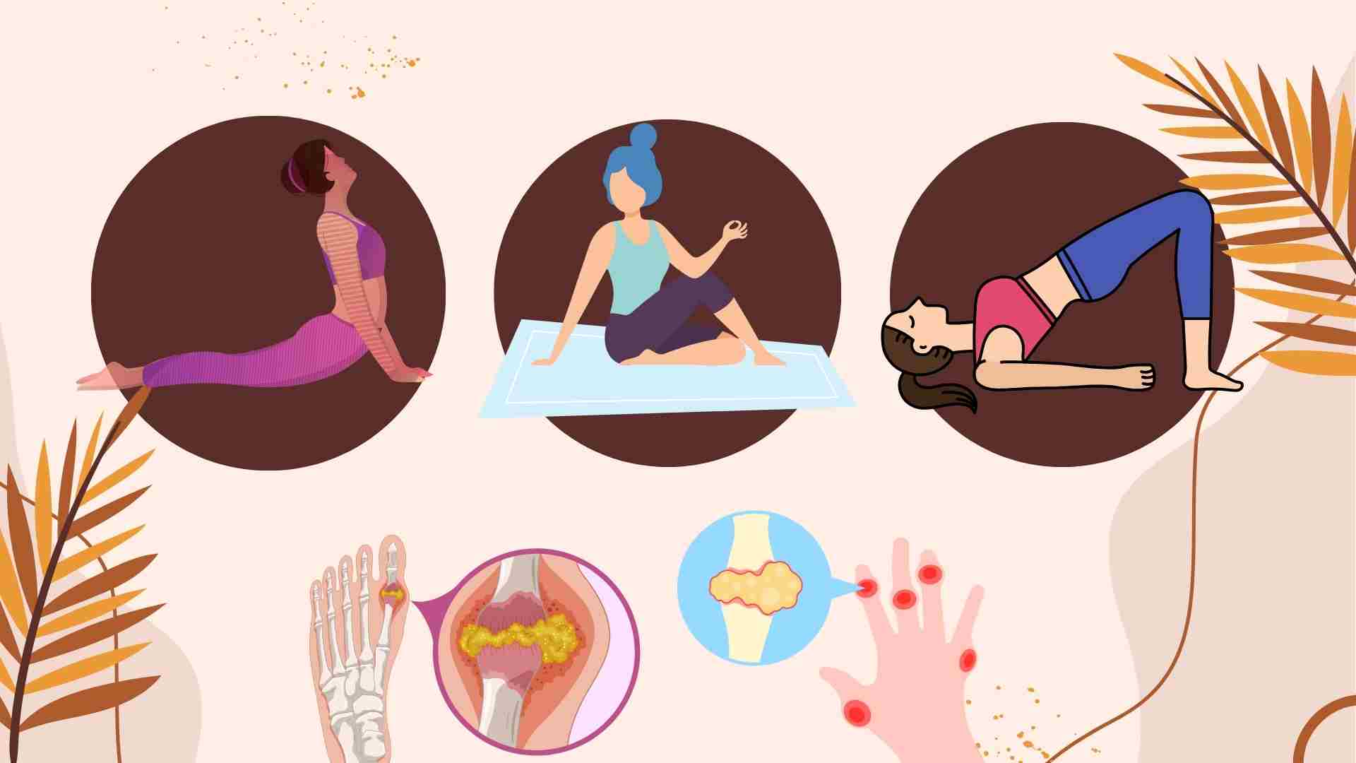 Prevent high uric acid with simple yoga exercises. Graphics: Ha May