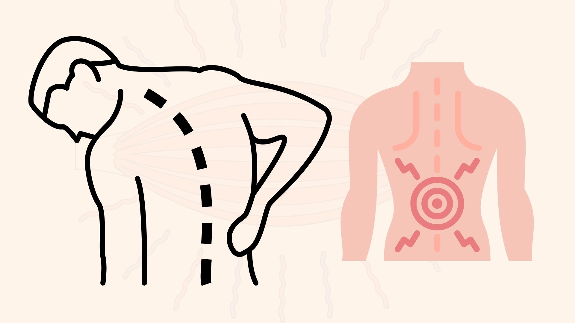 4 ejercicios para reducir la tension muscular de la espalda. Grafico: Dinh Dinh