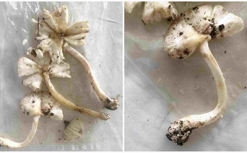The mushroom picked by people was poisoned and given emergency care at Bach Mai Hospital. Photo: BVCC