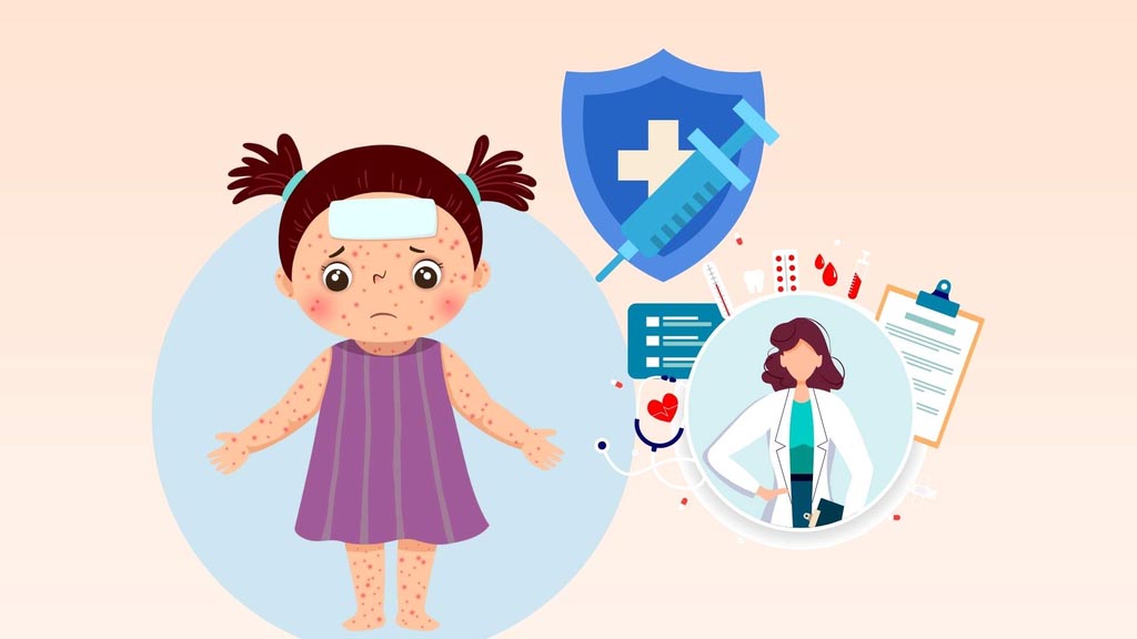 Measles causes dangerous complications, the Ministry of Health recommends special. Graphics: Dinh Dinh