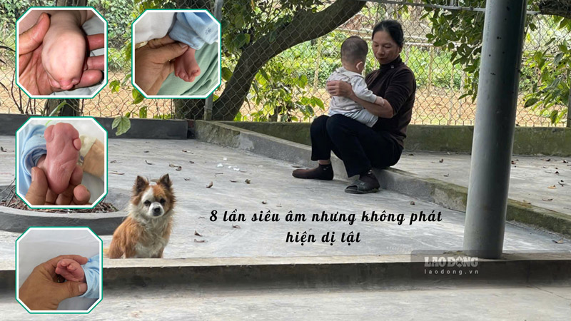 Although he had taken an ultrasound 8 times, no defect was detected. Photo: Dinh Dai