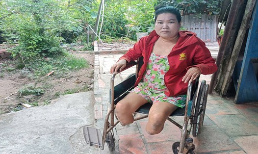 Người phụ nữ mất hai chân vì bệnh tiểu đường cần giúp đỡ. Ảnh: Hoàng Lộc