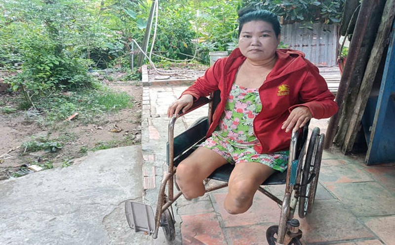 A woman who lost both legs to diabetes needs help. Photo: Hoang Loc