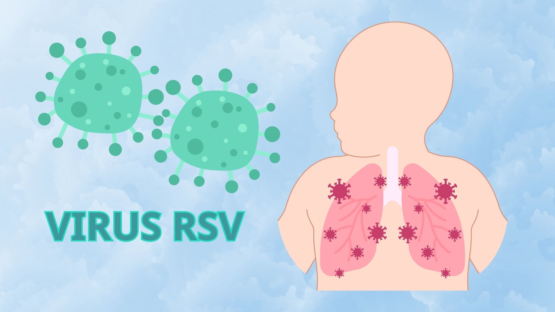 Group of people at high risk of RSV infection