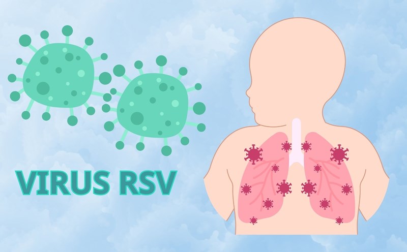 Group of people at high risk of RSV infection