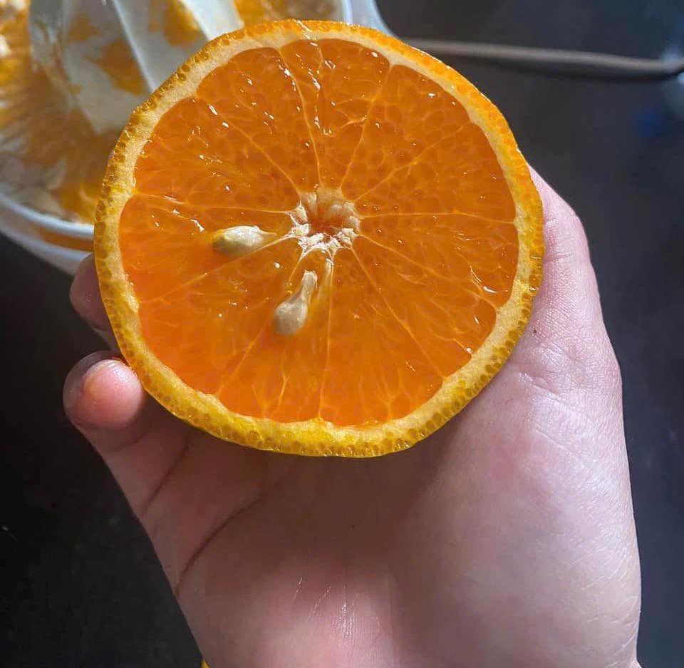 Supplementing calcium through natural foods is the best way to improve bone and body health. Photo: Quang Minh.