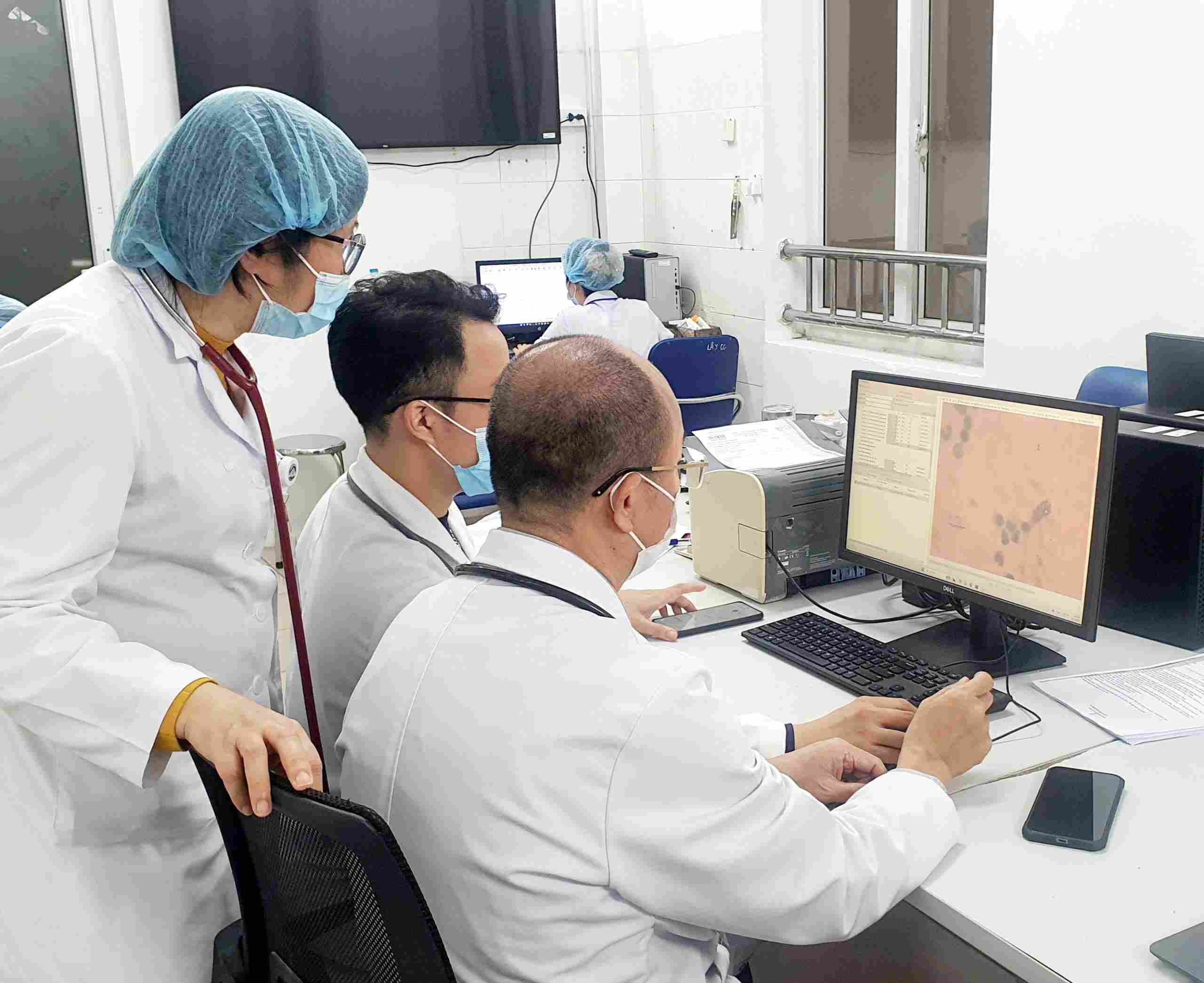 Doctors at Bach Mai Hospital examined the results of the brain drain screening for typhoon containing scoliosis bacteria. Photo: Nguyen Ha