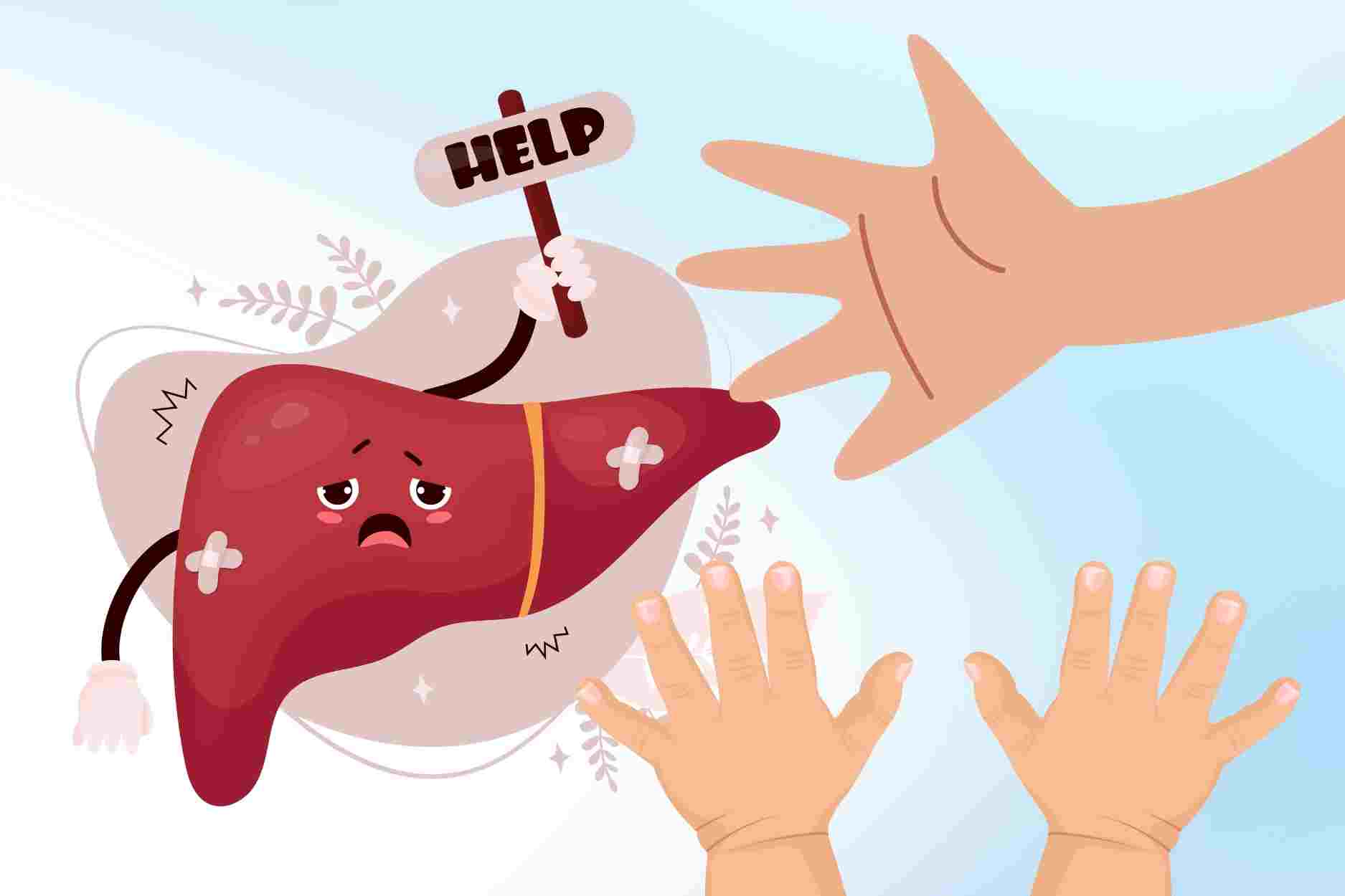 Unusual signs on the hands showing unhealthy liver