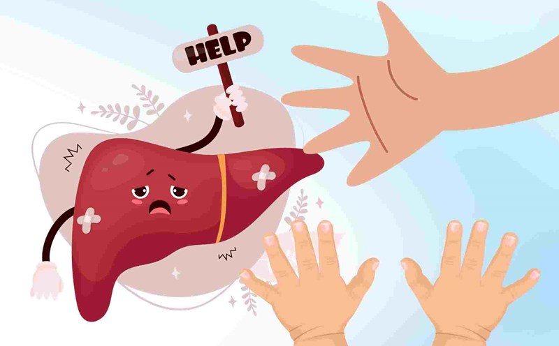 Unusual signs on the hands showing unhealthy liver