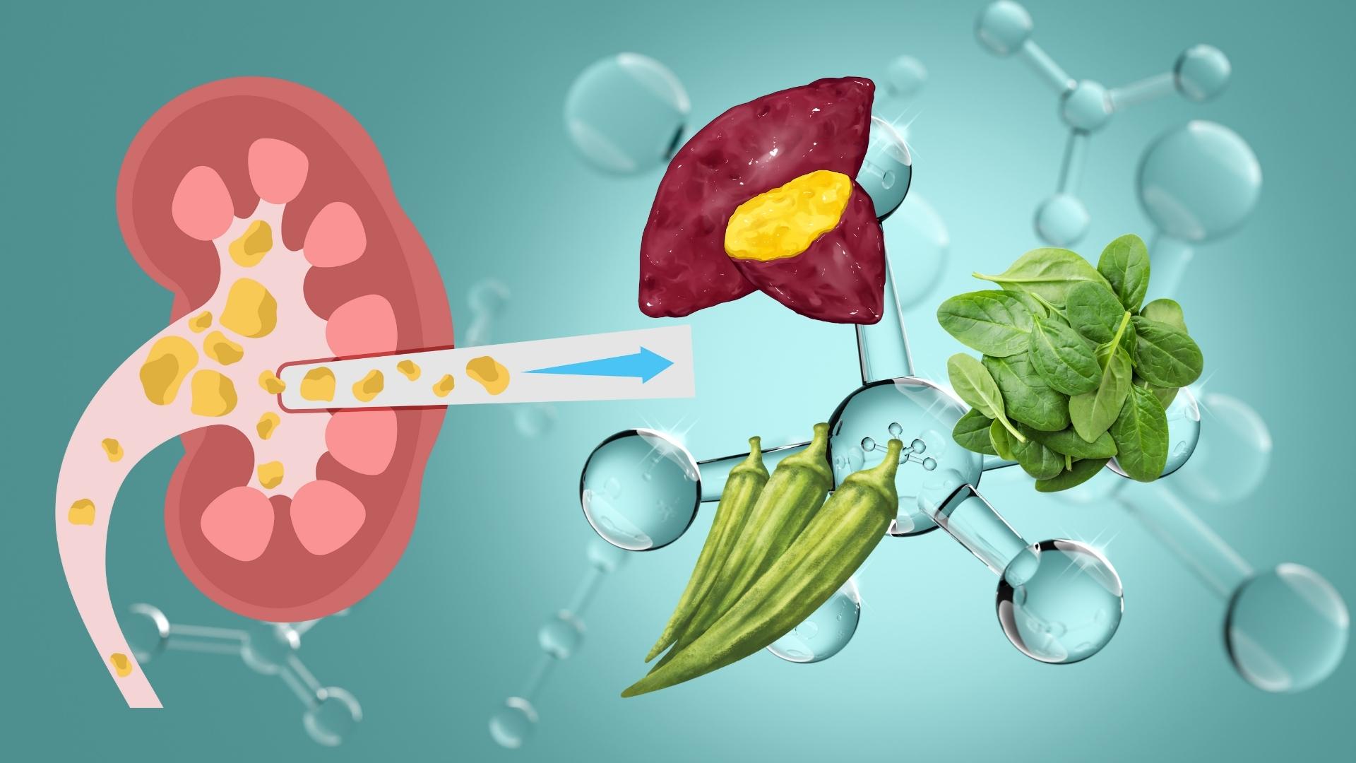 Las verduras pueden agravar la condicion de las piedras renales