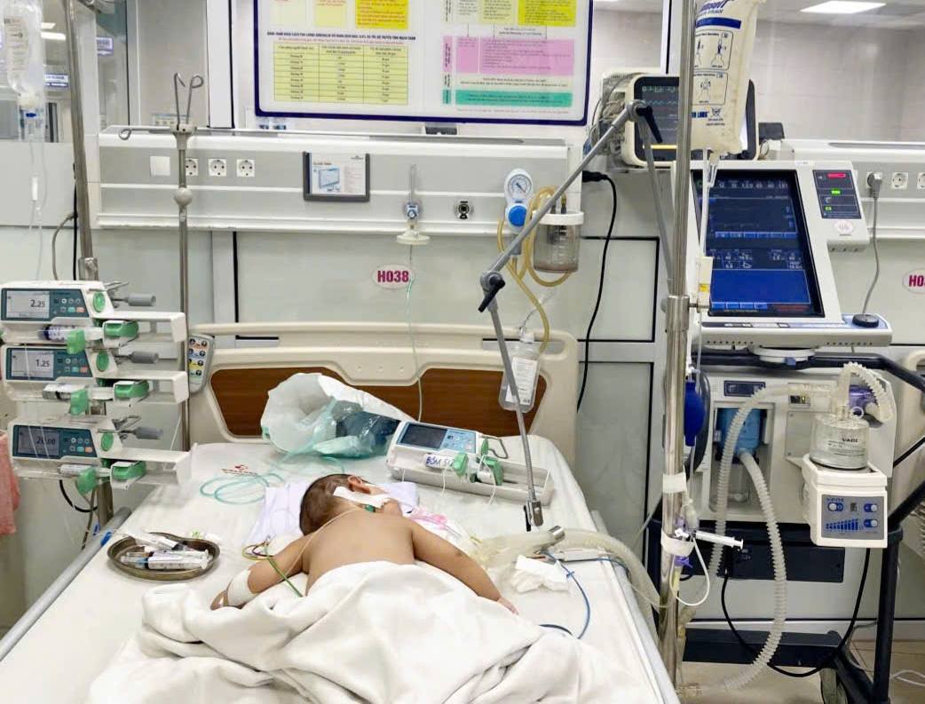 7-month-old patient with respiratory failure due to complications of influenza A. Illustrative photo: Phu Tho Province Maternity and Pediatrics Hospital