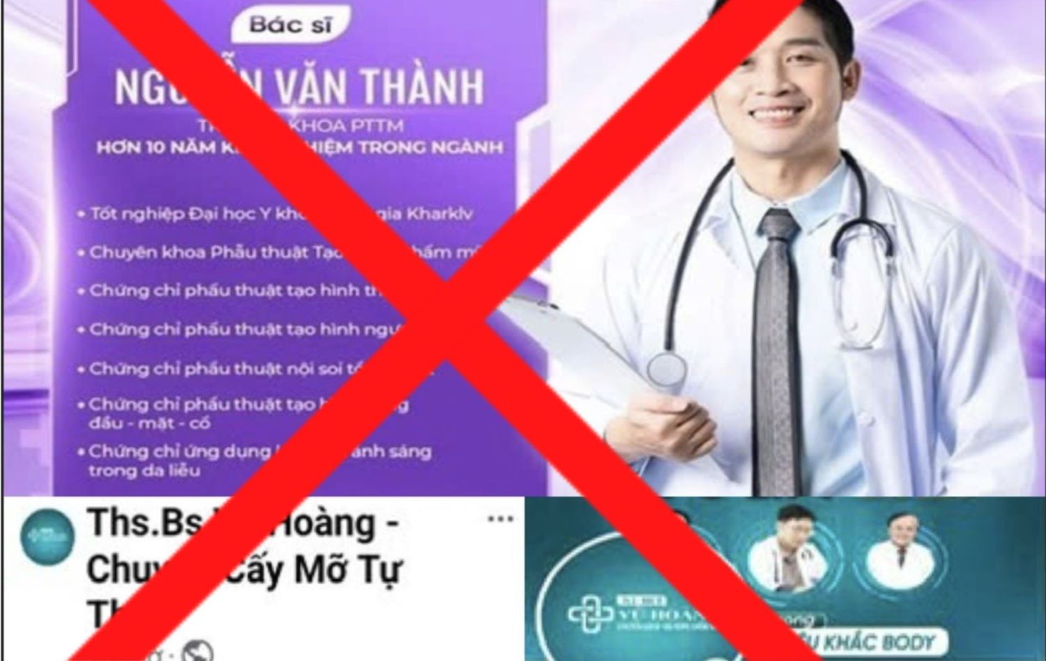 Trang Facebook quang cao trai phep “Bac Si Thanh - Chuyen Huy Mo Toan Than“, “ThS.BS Vu Hoang - Chuyen Cay Mo Tu Than“. Anh: So Y te TPHCM cung cap
