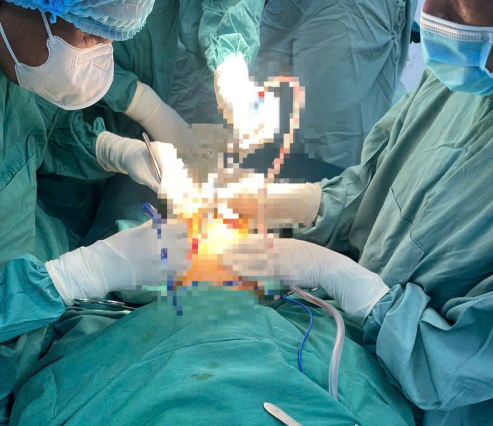 Thuan An City Medical Center has successfully received and performed emergency surgery on a case of a broken penis. Photo: Provided by TTYT TA