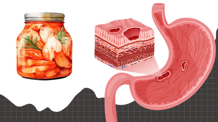 High uric acid, stomach ulcers should not eat this dish