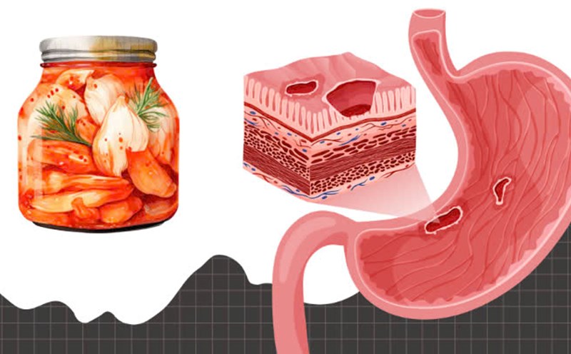 High uric acid, stomach ulcers should not eat this dish