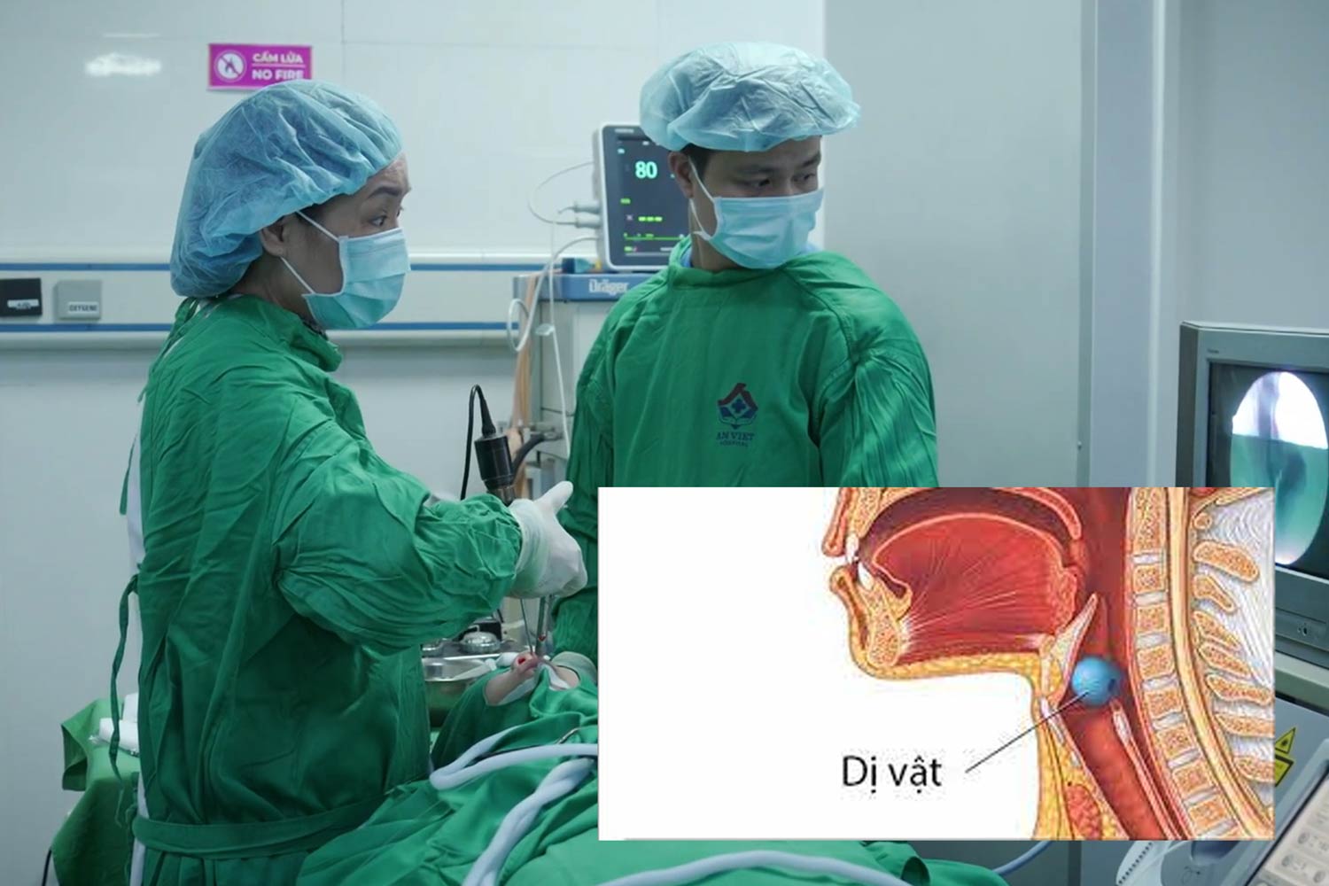 Alerta de riesgo frecuente de inflamacion de la nariz, dificultad respiratoria en niños