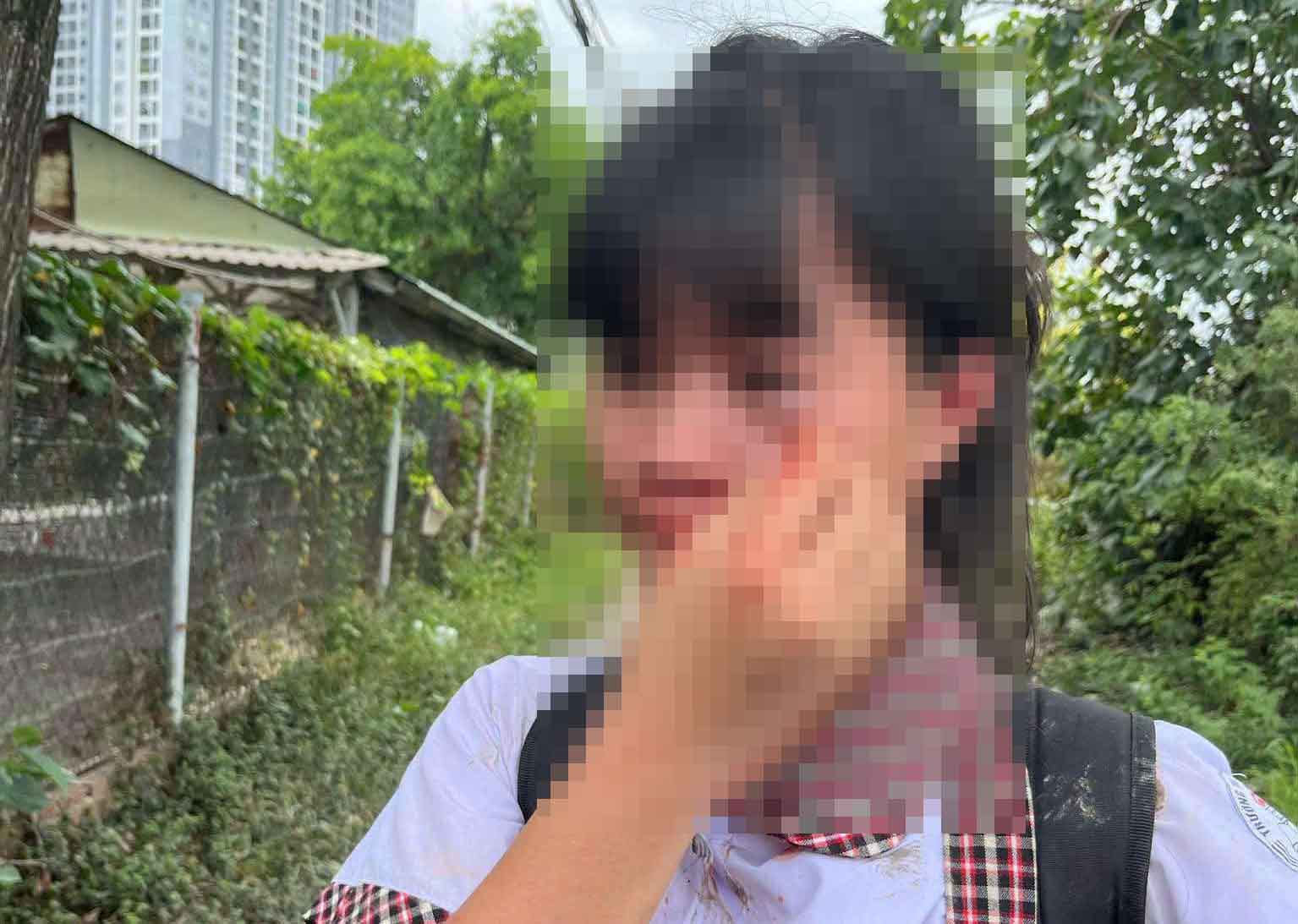 The student N.T.M.N was beaten by a group of female students. Photo: Cut video