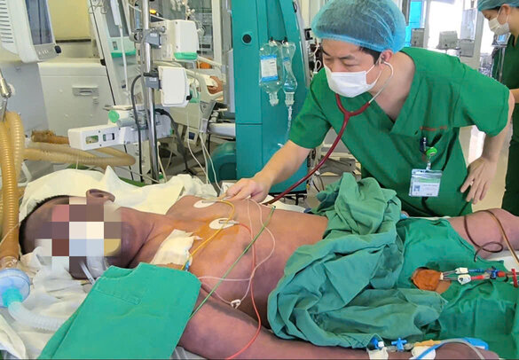 Hospitalized in critical condition