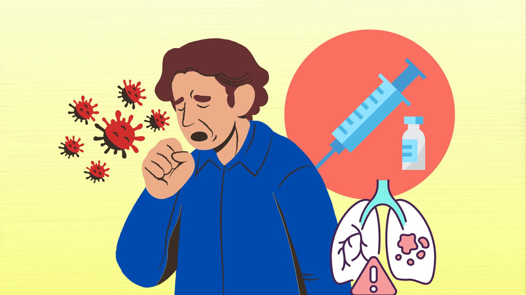 The Ministry of Health recommends how to prevent measles with a high risk group. Graphic: Dinh Dinh