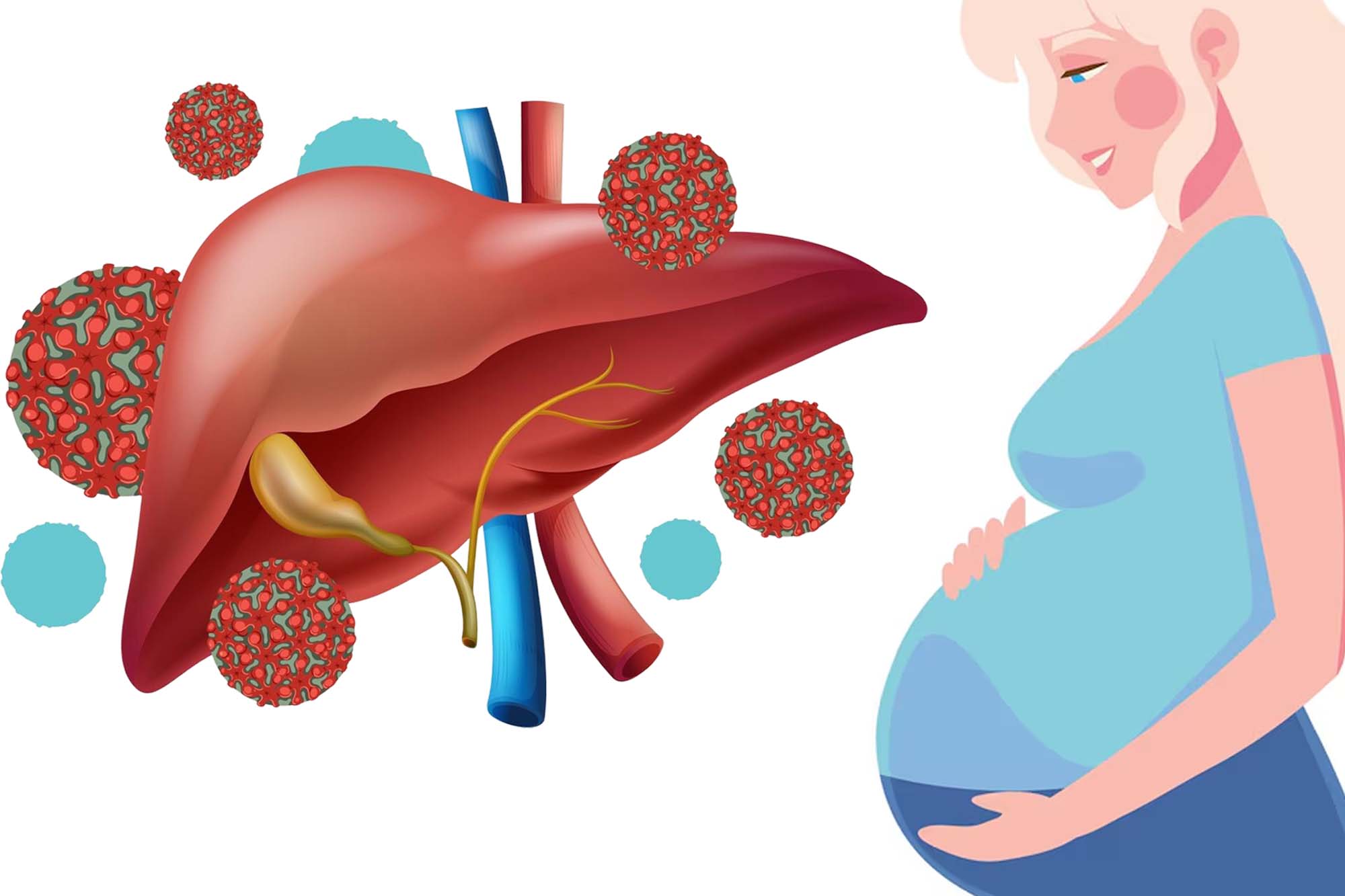 La hepatitis puede afectar a las mujeres embarazadas. El dibujo de la Virgen