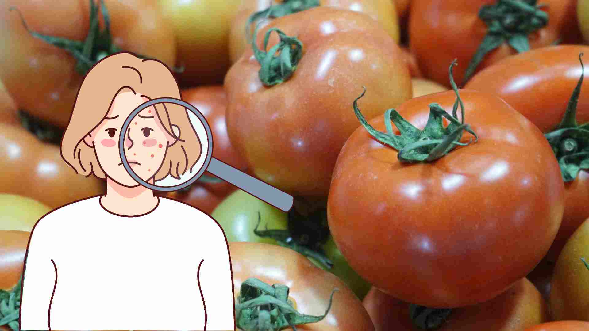 Los tomates ayudan a eliminar las celulas muertas, disminuyen las acne. Imagen: Bajo las nubes
