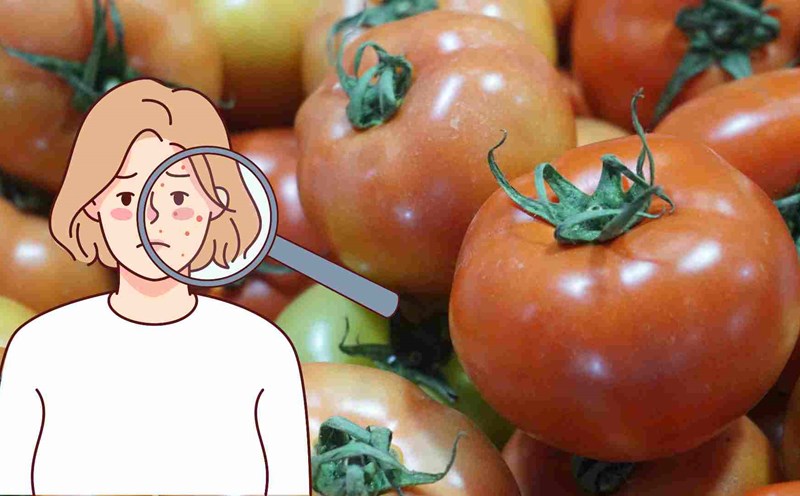 Tomatoes help exfoliate and reduce acne. Photo: Ha May