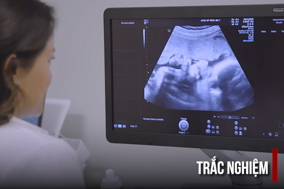 Lao động nam được nghỉ thai sản bao lâu khi vợ sinh con?