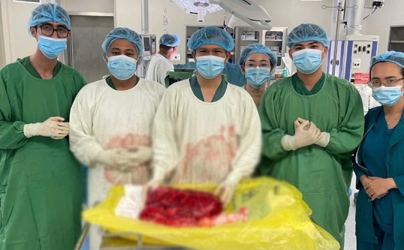 The tumor weighing about 8kg was removed from the body of a 60-year-old male patient. Photo: Kien Giang Oncology Hospital