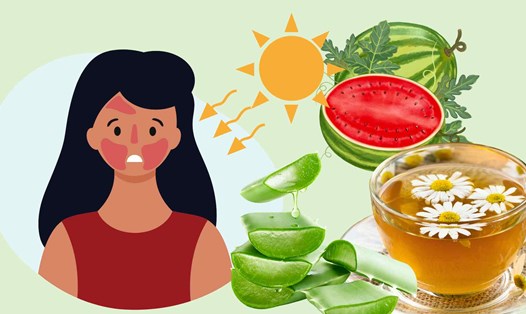 3 cách điều trị da mặt bị cháy nắng hiệu quả trong mùa hè. Ảnh đồ họa: Hoàng Lộc