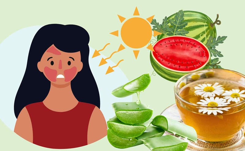 3 effective ways to treat sunburned faces in the summer. Graphic photo: Hoang Loc