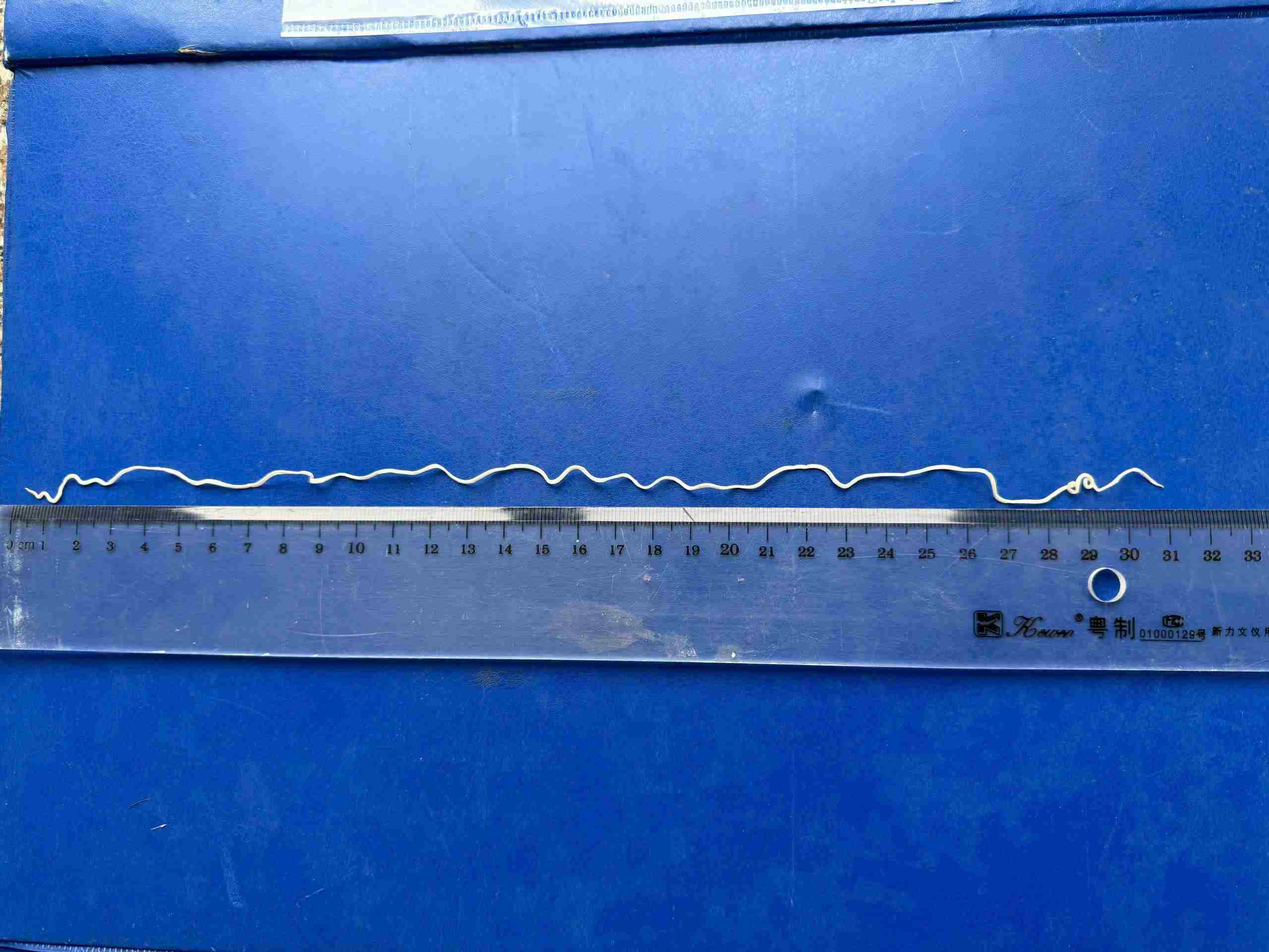 Recorded case of dragon worm disease in Vietnam. Photo: BSCC