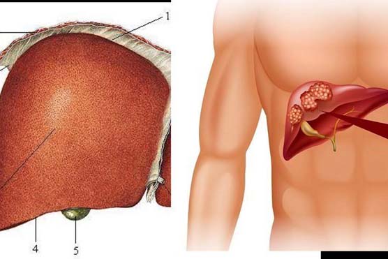 Un estilo de vida saludable y el consumo de alimentos frescos ricos en frutas y verduras, carne magra, reducen el riesgo de enfermedades hepaticas en un 50%. Diseñado por Nguyen Ly