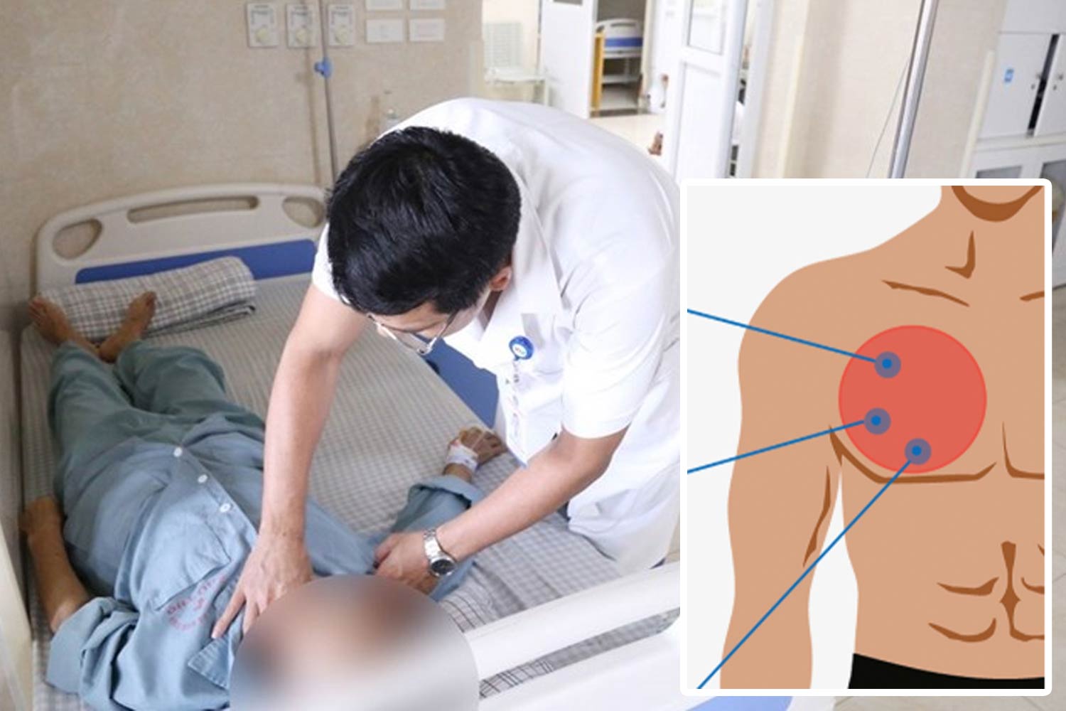 Rare cancer in men should absolutely not be subjective