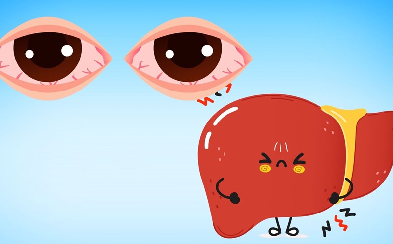 Signs in the eyes that warn of liver disease