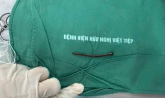 Chiếc đinh dài 6cm trong đầu người đàn ông được các y bác sĩ Bệnh viện Việt Tiệp (Hải Phòng) phẫu thuật thành công. Ảnh: Bệnh viện cung cấp