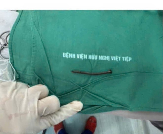 Cứu sống bệnh nhân ở Hải Phòng bị đinh dài 6cm đâm xuyên đỉnh sọ