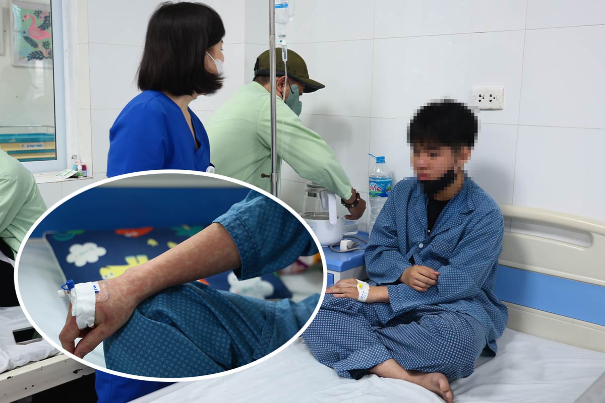 Adults still have measles, doctors recommend getting enough doses in the third phase of the campaign