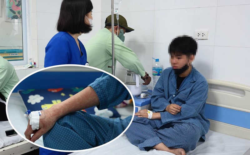Adults still have measles, doctors recommend getting enough doses in the third phase of the campaign