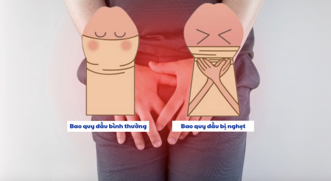 Los pacientes con estreñimiento de la circunferencia no deben tratarse por si mismos y necesitan ir al hospital para recibir intervencion. Foto: Hospitales que lo proveen