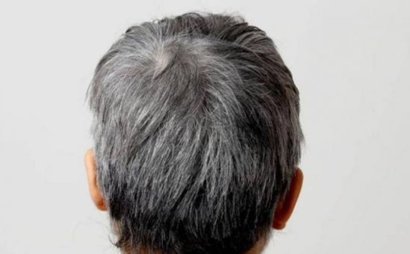 The aging process cannot be reversed but gray hair can be limited in middle-aged men. Photo: Tran Lam