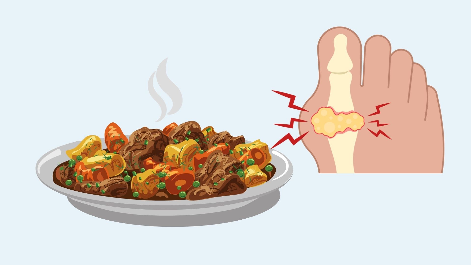 Dishes that easily increase uric acid in the blood. Graphics: Linh Dan