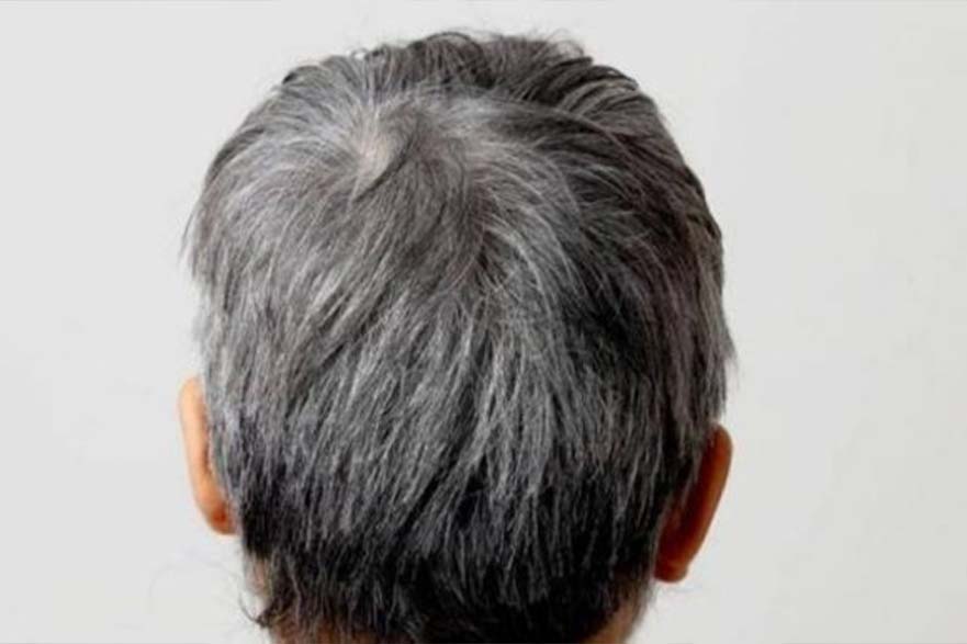 El pelo gris prematuro preocupa a muchas personas y las hace buscar soluciones. Pero la mayoria de los metodos de prevencion de la canalla en linea carecen de base cientifica. Imagen de la pelicula