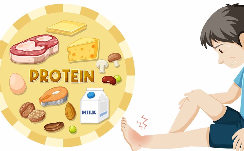 Protein deficiency can cause many health problems, including edema, a condition of swelling caused by fluid accumulation in the body. Graphics: Thien Nhan