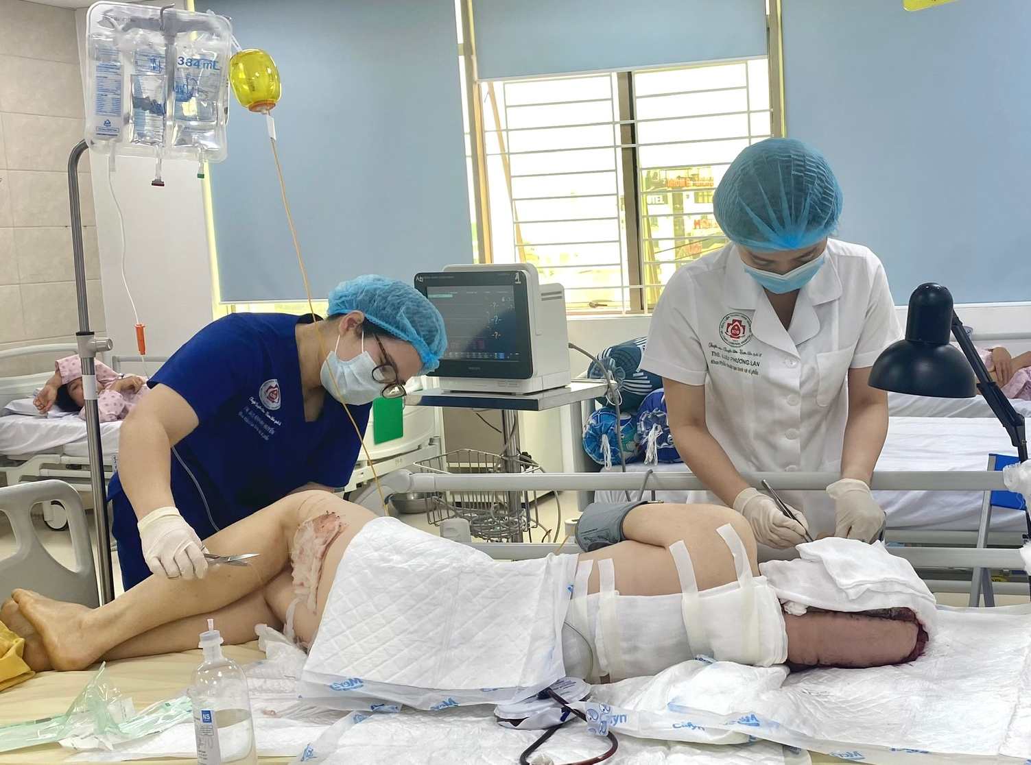 La paciente tenia la cabeza completamente arrancada por un accidente laboral. Imagen de la BVCC