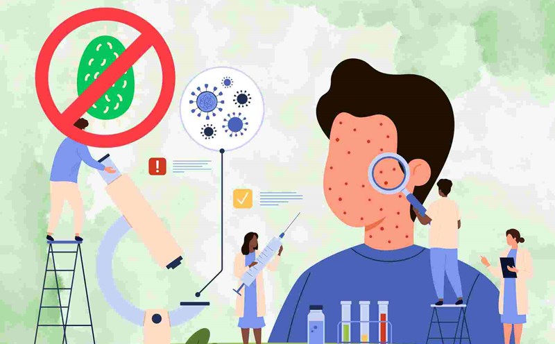 The Ministry of Health updates important new points in measles treatment guidelines