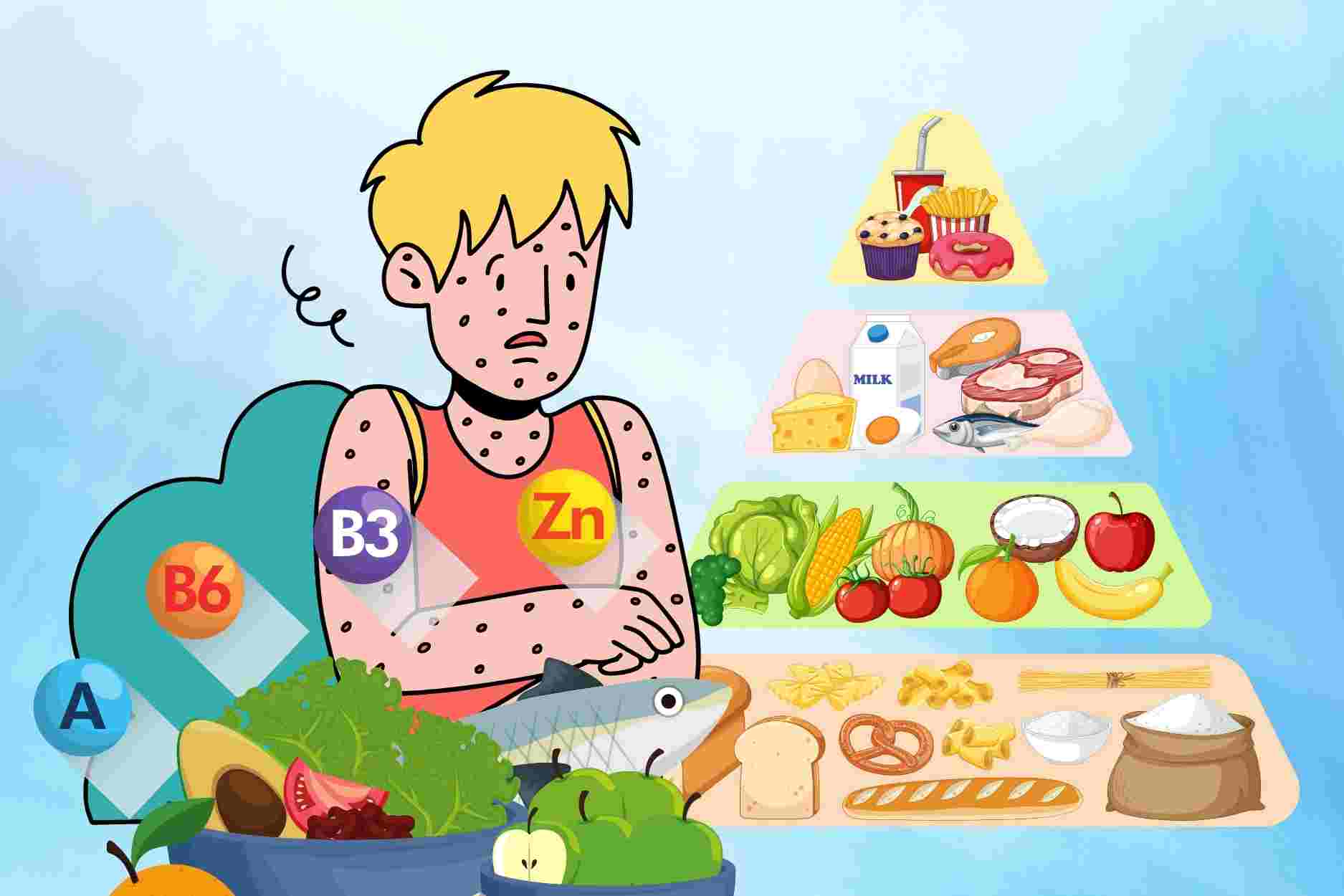 Nutrition helps measles patients recover quickly